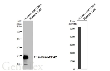 Anti-CPA2 antibody [HL5199] used in Western Blot (WB). GTX645451