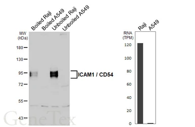 Anti-ICAM1 / CD54 antibody [GT342] used in Western Blot (WB). GTX645459