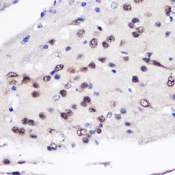 Anti-CUGBP1 antibody used in IHC (Paraffin sections) (IHC-P). GTX64547