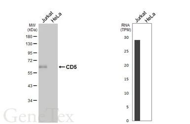 Anti-CD5 antibody [HL5244] used in Western Blot (WB). GTX645500