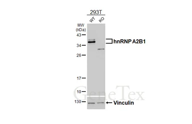 Anti-hnRNP A2B1 antibody [HL5249] used in Western Blot (WB). GTX645505