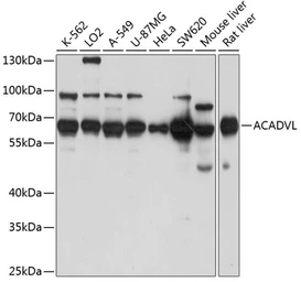 Anti-ACADVL antibody used in Western Blot (WB). GTX64566