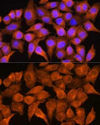 Anti-AOX1 antibody used in Immunocytochemistry/ Immunofluorescence (ICC/IF). GTX64571