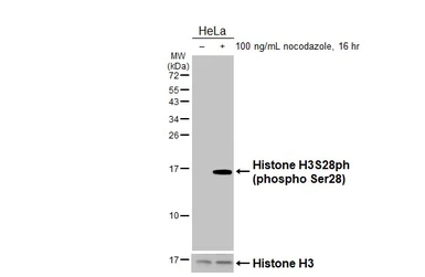 Anti-Histone H3S28ph (phospho Ser28) antibody [HL5300] used in Western Blot (WB). GTX645765