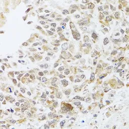 Anti-RNase L antibody used in IHC (Paraffin sections) (IHC-P). GTX64577