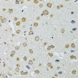 Anti-RNase L antibody used in IHC (Paraffin sections) (IHC-P). GTX64577