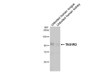 Anti-TAS1R3 antibody [HL5310] used in Western Blot (WB). GTX645775