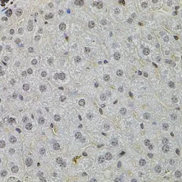 Anti-SKP2 antibody used in IHC (Paraffin sections) (IHC-P). GTX64578