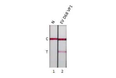 Anti-Enterovirus D68 VP1 antibody [HL5333] used in Lateral Flow (Lateral Flow). GTX645811