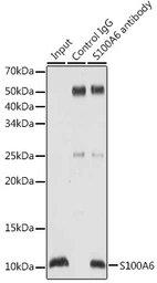 Anti-S100A6 antibody used in Immunoprecipitation (IP). GTX64584