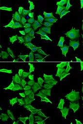 Anti-HAI-2 antibody used in Immunocytochemistry/ Immunofluorescence (ICC/IF). GTX64596