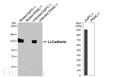 Anti-LI-Cadherin antibody [HL5394] used in Western Blot (WB). GTX645962