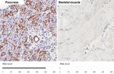 Anti-SLC4A4 antibody [HL5413] used in IHC (Paraffin sections) (IHC-P). GTX645981