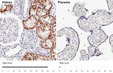 Anti-SLC4A4 antibody [HL5413] used in IHC (Paraffin sections) (IHC-P). GTX645981