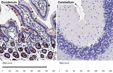 Anti-SPINK4 antibody [HL5418] used in IHC (Paraffin sections) (IHC-P). GTX645986