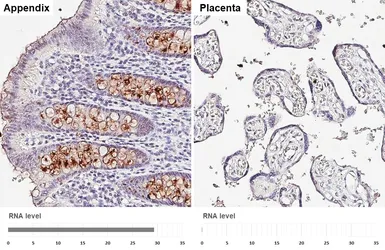 Anti-SPINK4 antibody [HL5418] used in IHC (Paraffin sections) (IHC-P). GTX645986