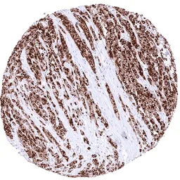 Anti-GPRC5A antibody [HMV4717] HistoMAX&trade; used in IHC (Paraffin sections) (IHC-P). GTX645997
