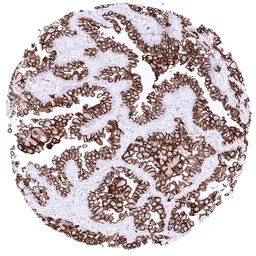 Anti-GPRC5A antibody [HMV4717] HistoMAX&trade; used in IHC (Paraffin sections) (IHC-P). GTX645997