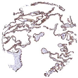 Anti-GPRC5A antibody [HMV4717] HistoMAX&trade; used in IHC (Paraffin sections) (IHC-P). GTX645997