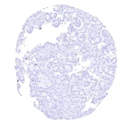 Anti-GFAP antibody [HMV4718] HistoMAX&trade; used in IHC (Paraffin sections) (IHC-P). GTX645998