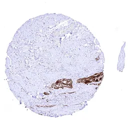 Anti-GFAP antibody [HMV4718] HistoMAX&trade; used in IHC (Paraffin sections) (IHC-P). GTX645998