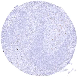Anti-MMP9 antibody [HMV4720] HistoMAX&trade; used in IHC (Paraffin sections) (IHC-P). GTX646000