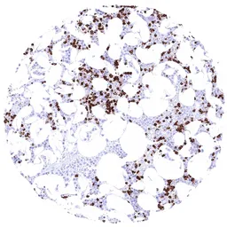 Anti-MMP9 antibody [HMV4720] HistoMAX&trade; used in IHC (Paraffin sections) (IHC-P). GTX646000