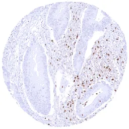 Anti-MMP9 antibody [HMV4720] HistoMAX&trade; used in IHC (Paraffin sections) (IHC-P). GTX646000