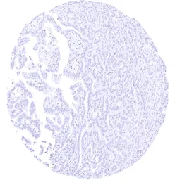 Anti-GABA Transporter 1 / GAT1 antibody [HMV4721] HistoMAX&trade; used in IHC (Paraffin sections) (IHC-P). GTX646001