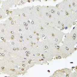 Anti-RPB2 antibody used in IHC (Paraffin sections) (IHC-P). GTX64604