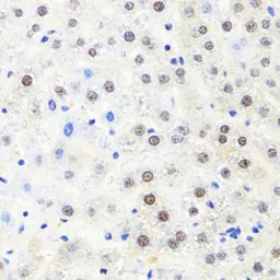Anti-RPB2 antibody used in IHC (Paraffin sections) (IHC-P). GTX64604