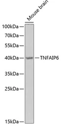 Anti-TSG6 antibody used in Western Blot (WB). GTX64605