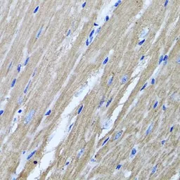 Anti-TSG6 antibody used in IHC (Paraffin sections) (IHC-P). GTX64605