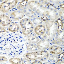 Anti-TSG6 antibody used in IHC (Paraffin sections) (IHC-P). GTX64605
