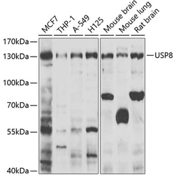 Anti-USP8 antibody used in Western Blot (WB). GTX64608