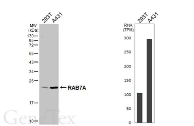 Anti-RAB7A antibody [HL5462] used in Western Blot (WB). GTX646104