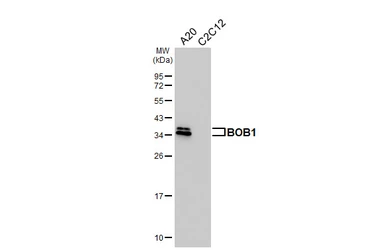 Anti-BOB1 antibody [HL5492] used in Western Blot (WB). GTX646156
