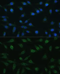 Anti-NUP98 antibody used in Immunocytochemistry/ Immunofluorescence (ICC/IF). GTX64618