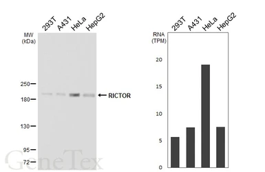 Anti-RICTOR antibody [HL5521] used in Western Blot (WB). GTX646184