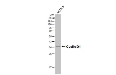 Anti-Cyclin D1 antibody [HL5522] used in Western Blot (WB). GTX646185