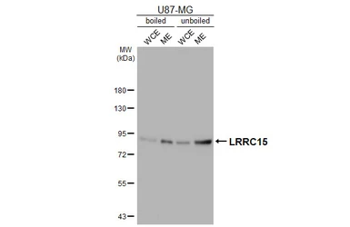 Anti-LRRC15 antibody [HL5542] used in Western Blot (WB). GTX646216