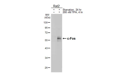 Anti-c-Fos antibody [HL5568] used in Western Blot (WB). GTX646242
