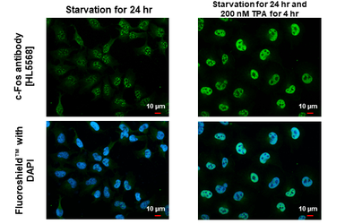 Anti-c-Fos antibody [HL5568] used in Immunocytochemistry/ Immunofluorescence (ICC/IF). GTX646242