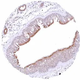 Anti-Bcl-XL antibody [HMV4724] HistoMAX&trade; used in IHC (Paraffin sections) (IHC-P). GTX646253