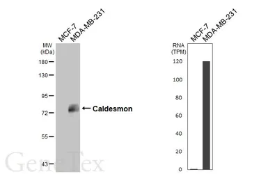 Anti-Caldesmon antibody [HL5575] used in Western Blot (WB). GTX646257