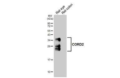 Anti-CORD2 antibody [HL5578] used in Western Blot (WB). GTX646260