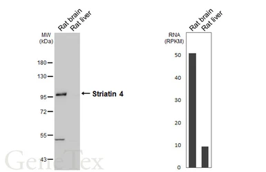 Anti-Striatin 4 antibody [HL5583] used in Western Blot (WB). GTX646265