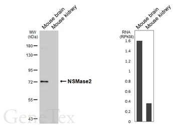 Anti-NSMase2 antibody [HL5589] used in Western Blot (WB). GTX646271