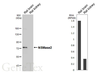 Anti-NSMase2 antibody [HL5589] used in Western Blot (WB). GTX646271