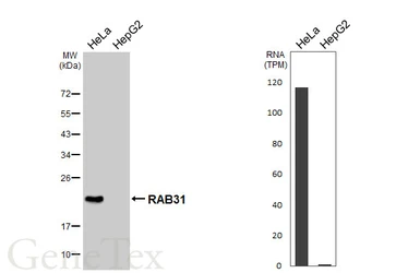 Anti-RAB31 antibody [HL5595] used in Western Blot (WB). GTX646277